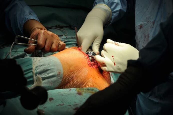 Surgical treatment