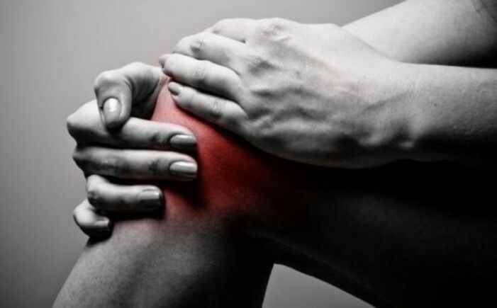 Arthritis of the knee joint