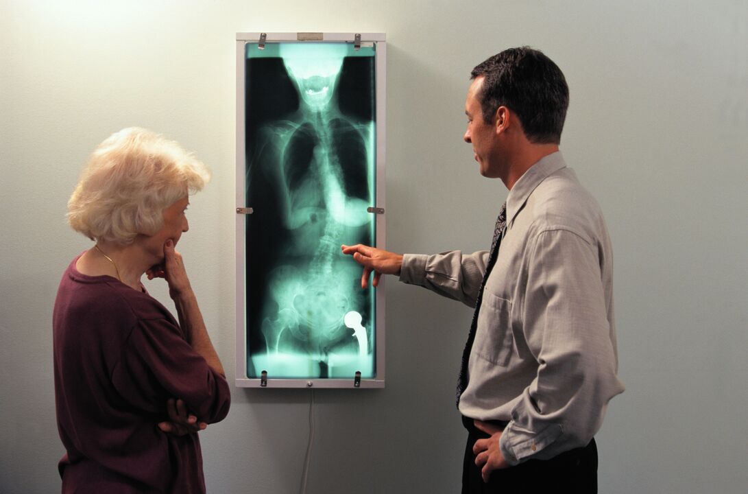 x-ray diagnosis for hip joint pain