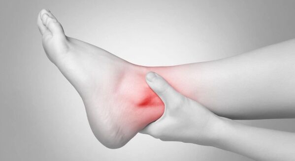 Joint stiffness and chronic ankle pain are complications of cruciate arthritis