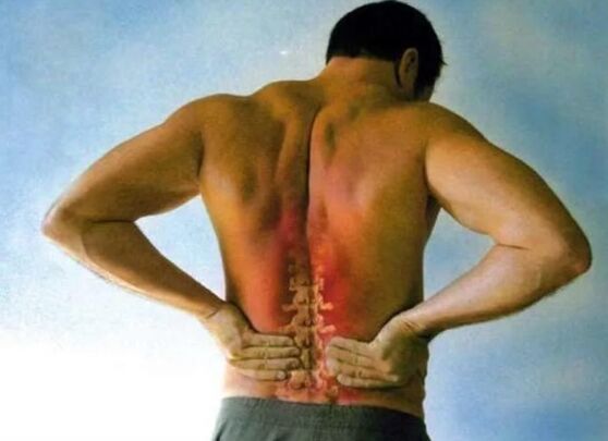 Pain for lumbar osteochondosis